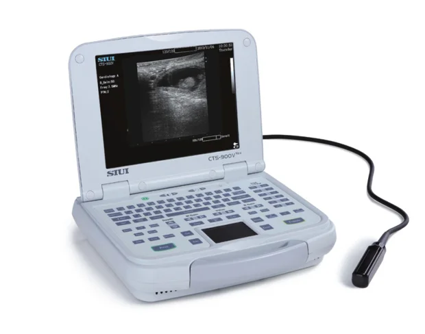 Ultrasonido cts 900